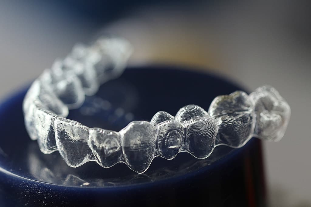 Ortodoncia Invisalign en Alicante