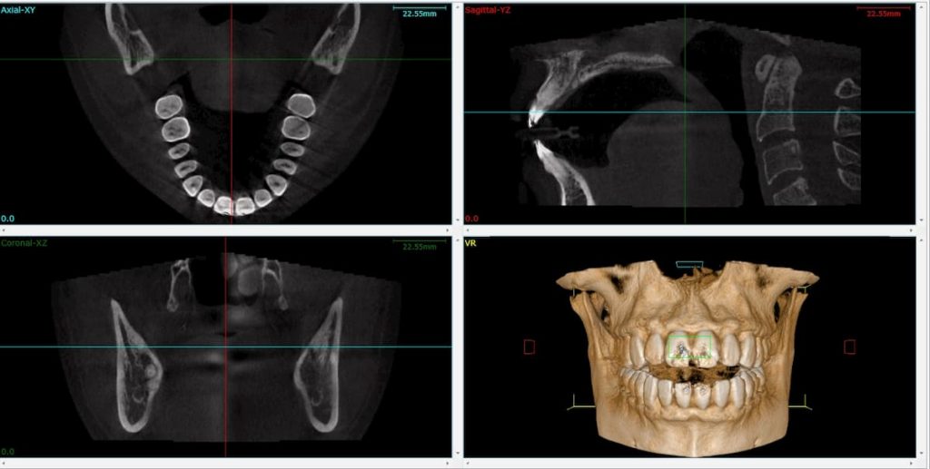 Radiologia dental tac 3d