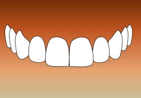 Diseño digital de la sonrisa