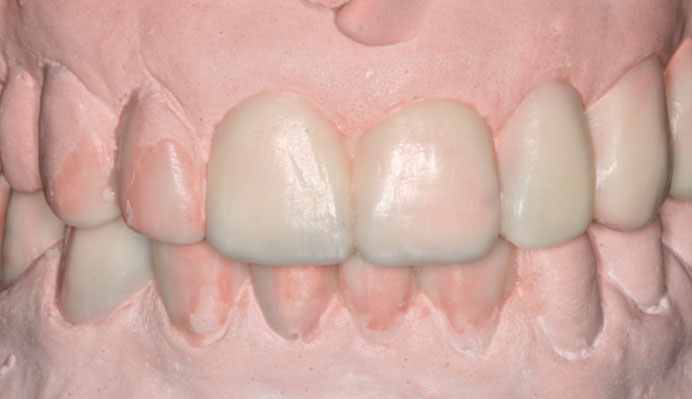 Morfología Dental