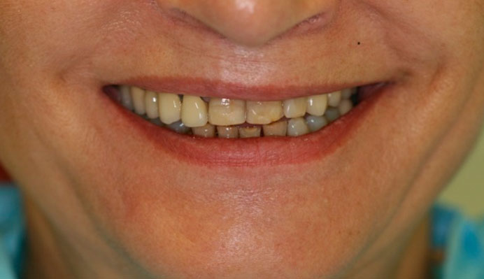 Morfología Dental