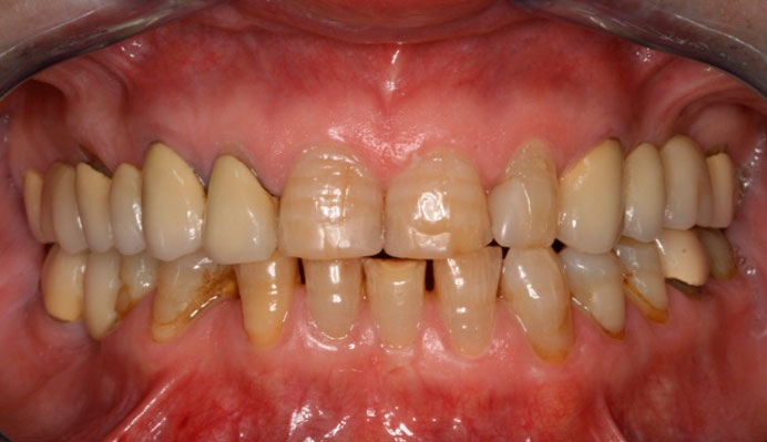 Morfología Dental