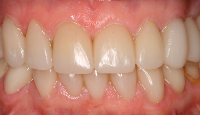 Morfología Dental